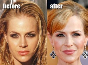 Julie Benz Plastic Surgery: Regaining a Youthful Look