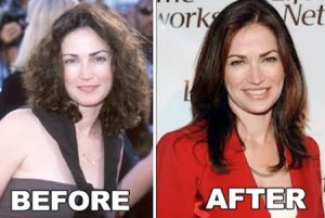 Kim Delaney Plastic Surgery: Lip Work Gone Bad