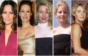 Linda Kozlowski Plastic Surgery: Poorly Done Procedures