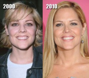 Mary McCormack Plastic Surgery: Beautiful Lips Made Even Better