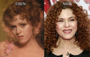 Bernadette Peters Plastic Surgery – A Perfect Look at Old Age