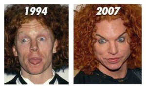 Carrot Top Plastic Surgery – Cosmetic Operation Gone Bad
