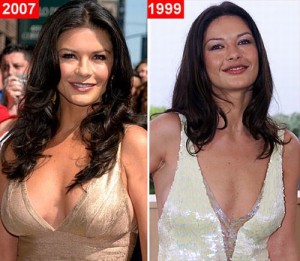 Catherine Zeta Jones Plastic Surgery Was Awesome!