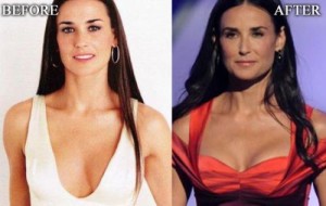 Demi Moore Plastic Surgery – Eye-Catching and Charming Beauty