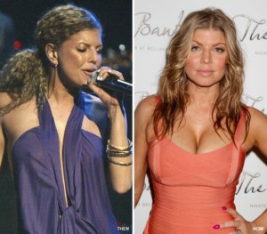 Fergie Plastic Surgery Before and After – Job Well Done