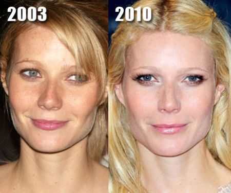 Gwyneth Paltrow plastic surgery before after