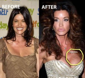Was Janice Dickinson Plastic Surgery the Reason for Her Bankruptcy?