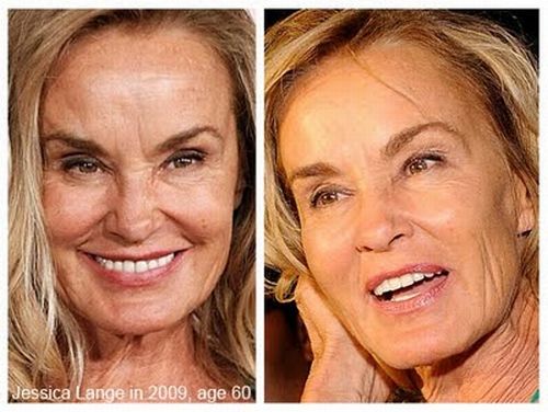 Jessica Lange plastic surgery before and after