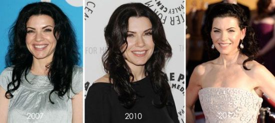 Julianna Margulies plastic surgery before after