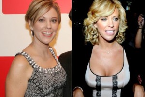 Kate Gosselin Plastic Surgery – A Life Changing Operation