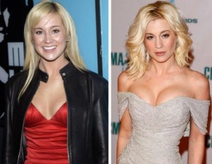 Kellie Pickler Plastic Surgery – Breast Implants, Botox & Facelift
