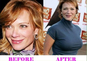 Lauren Holly Plastic Surgery – An Awesome Makeover