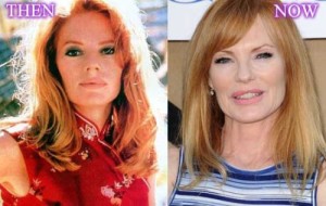 Marg Helgenberger Plastic Surgery – Done in a Clinical Way