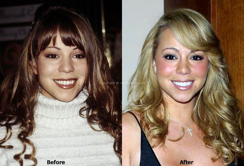 Mariah Carey Plastic Surgery Done Modestly With Skill