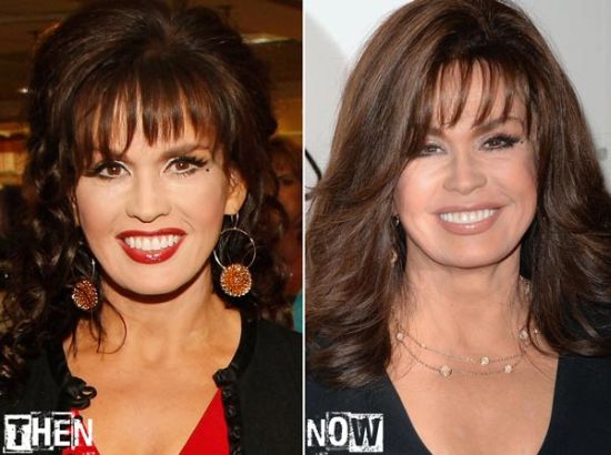 Marie Osmond then and now