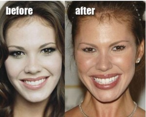 Nikki Cox Plastic Surgery – The Ultimate Career Killer