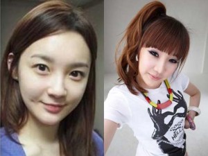 Park Bom Plastic Surgery – An Awful Surgical Procedure