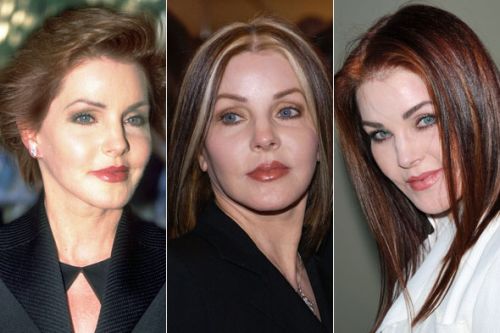 Priscilla Presley plastic surgery before and after