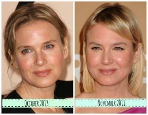 Renee Zellweger Plastic Surgery – Mixture of Skill and Technology