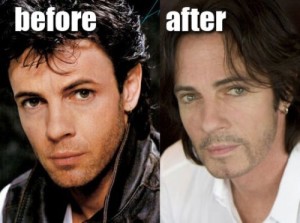 Rick Springfield Plastic Surgery – Was It a Success?