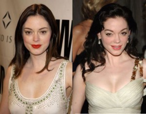 Rose McGowan Plastic Surgery Gone Wrong – Before & After Pics