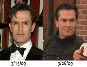 Rupert Everett Plastic Surgery That Has Lengthened His Career