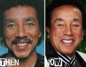 Smokey Robinson Plastic Surgery – An Unnatural Youthful Look
