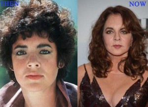 Did Stockard Channing Have Plastic Surgery – Before & After Photos