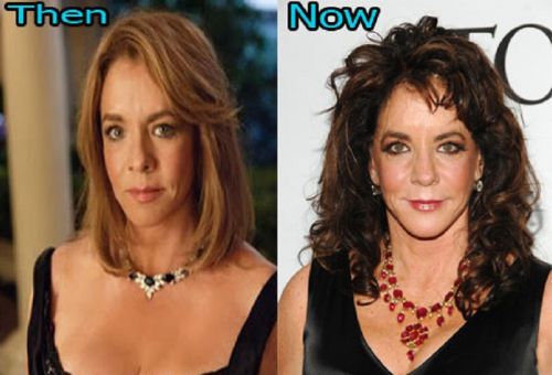 Stockard Channing plastic surgery before and after