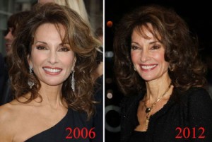 Susan Lucci Plastic Surgery Made Her Look Younger