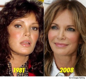 Jaclyn Smith Plastic Surgery Before and After
