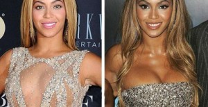 Beyonce Plastic Surgery Before & After: A Successful Procedure