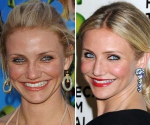 Cameron Diaz Plastic Surgery – Nose Job & Botox
