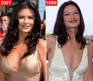 15 Best Celebrity Plastic Surgery Before and After