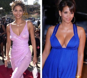 Halle Berry Plastic Surgery Gives Her The Best Nose