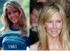 Heather Locklear Plastic Surgery Triggers Her Rebirth