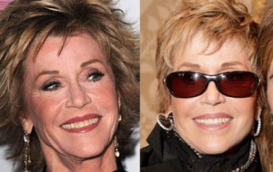 Jane Fonda Plastic Surgery – A Beautiful Old Age Present