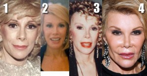Joan Rivers Before and After Plastic Surgery Photos