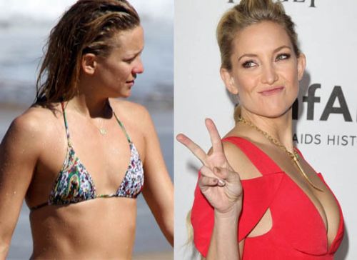 Kate Hudson breast implants before and after