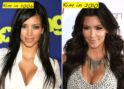 Kim kardashian plastic surgery before and after