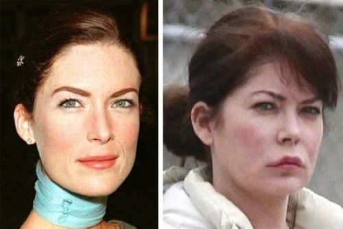Lara Flynn Boyle plastic surgery before and after