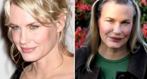 Daryl Hannah Plastic Surgery Makes Her Look Weird