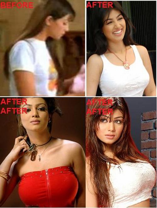 Ayesha Takia plastic surgery before and after