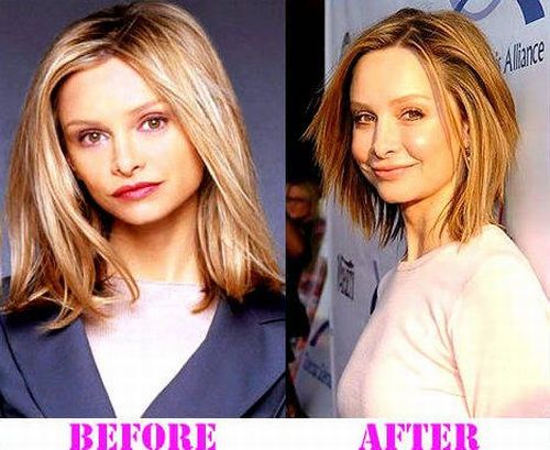Calista Flockhart plastic surgery before and after