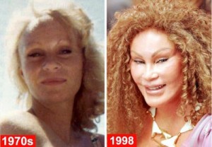 Catwoman (Jocelyn Wildenstein) Plastic Surgery Disaster Pictures