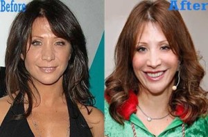 Cheri Oteri Plastic Surgery Before and After Pictures