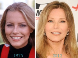 Cheryl Ladd Plastic Surgery Was a Great Success