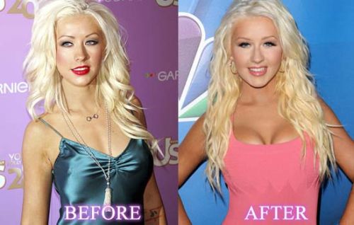 Christina Aguilera breast implants before and after