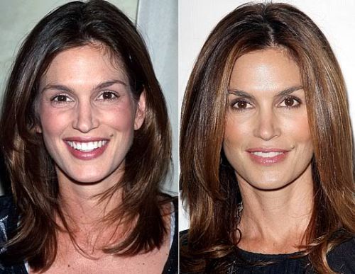 Cindy Crawford plastic surgery before and after