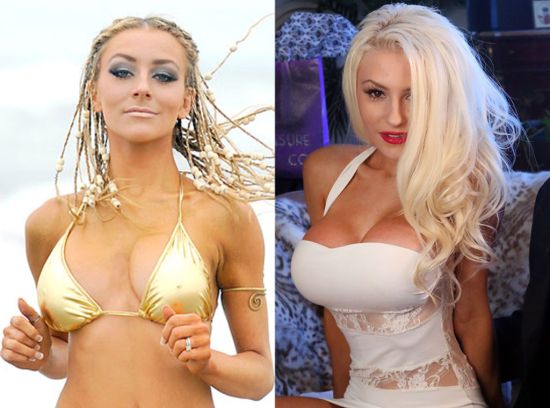 Courtney Stodden plastic surgery before and after